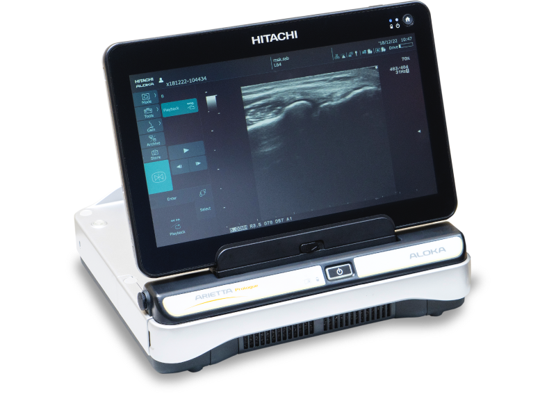 エコー画像観察装置