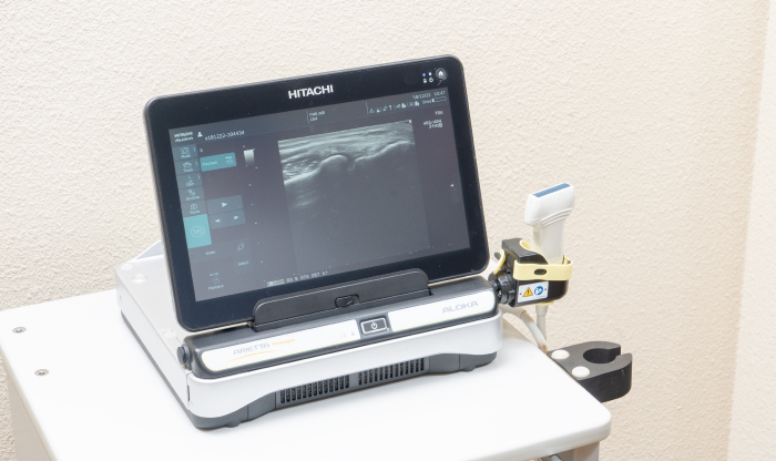 エコー画像観察装置(エコー)